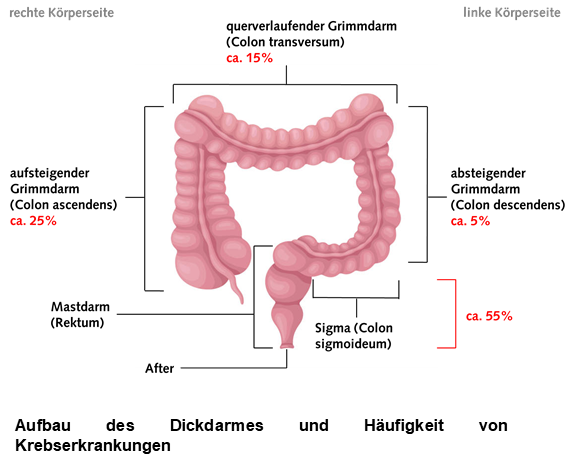 dickdarm-darmkrebszentrum-waldkrankenhaus-erlangen