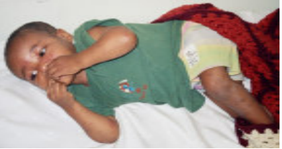 Young child lying on a blanket.