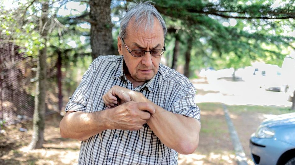 Ein älterer Mann mit Brille und kurzem Hemd kratzt sich am linken Arm.