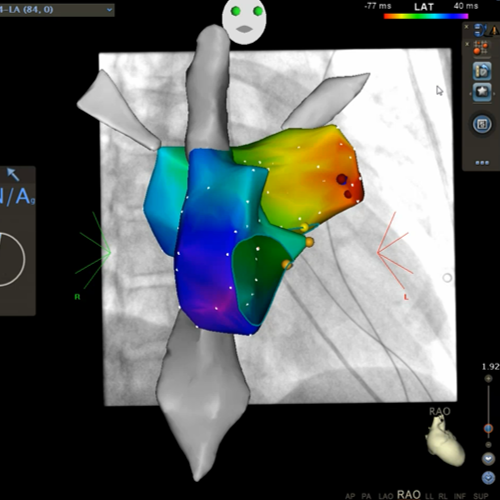 herzvorhoefe_Bild1a-kardiologie-angiologie-waldkrankenhaus-erlangen