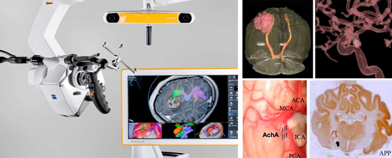 OP-Ausstattung der Neurochirurgie 