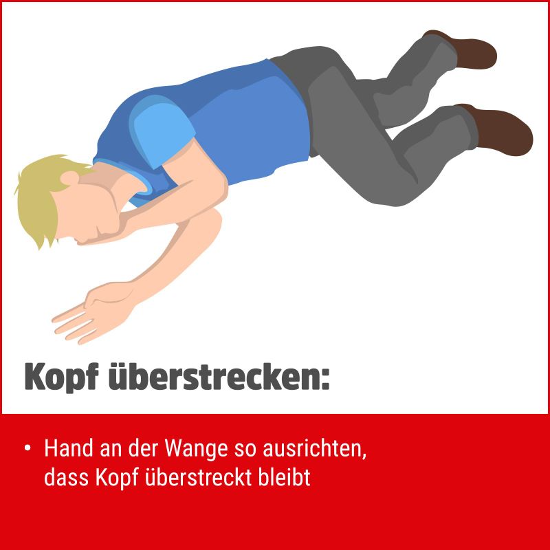 Stabile Seitenlage "kopf überstrecken"