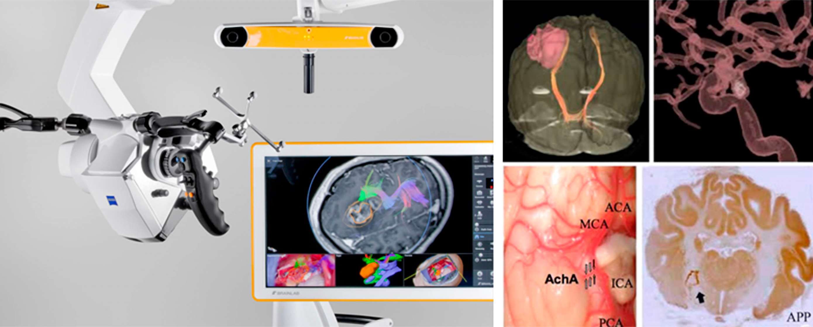 OP-Ausstattung der Neurochirurgie 