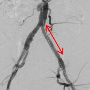 angiologie-1b-kardiologie-angiologie-waldkrankenhaus-erlangen