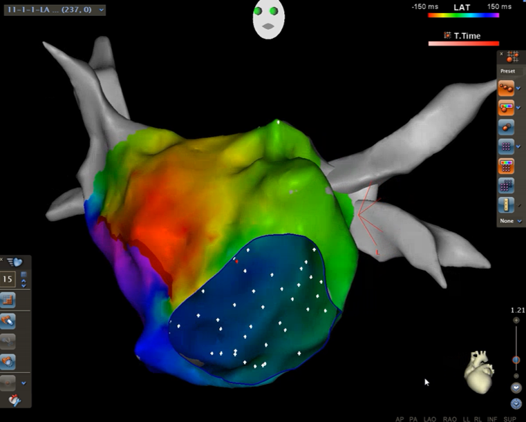 linker-herzvorhof-kardiologie-angiologie-waldkrankenhaus-erlangen