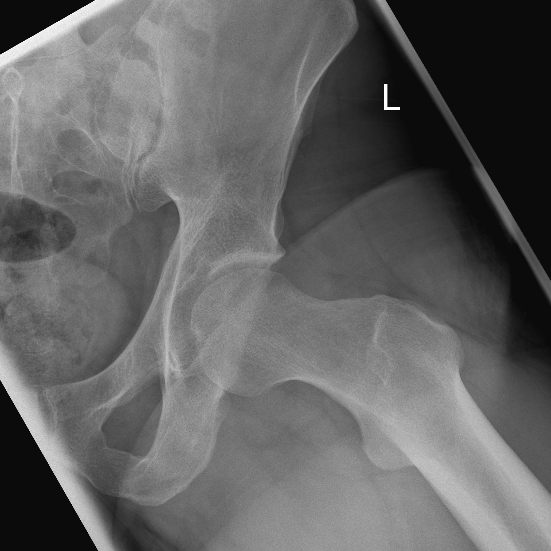 huefte-orthopaedie-unfallchirurgie-waldkrankenhaus-erlangen