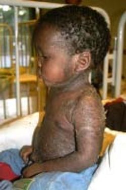 A boy sits in profile on a hospice bed.