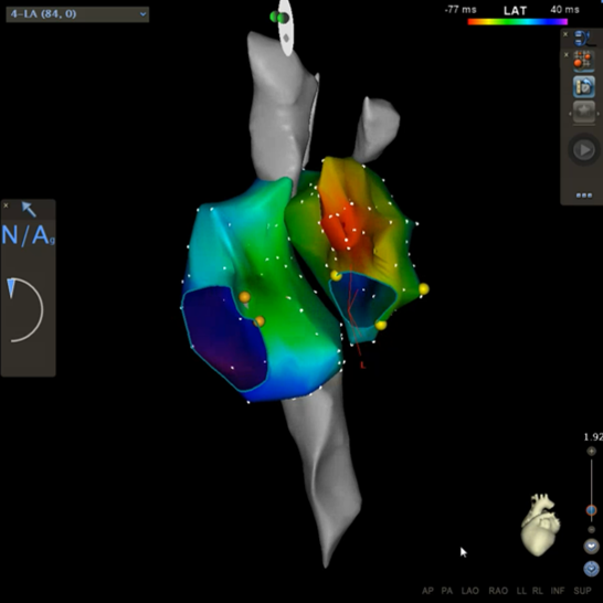 herzvorhoefe_Bild1b-kardiologie-angiologie-waldkrankenhaus-erlangen