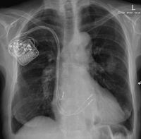 ccm-system-kardiologie-angiologie-waldkrankenhaus-erlangen