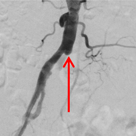 angiologie-1a-kardiologie-angiologie-waldkrankenhaus-erlangen