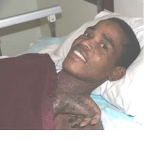 Mthokozisi smiling in a hospice bed; newsletter no. 36, 2017