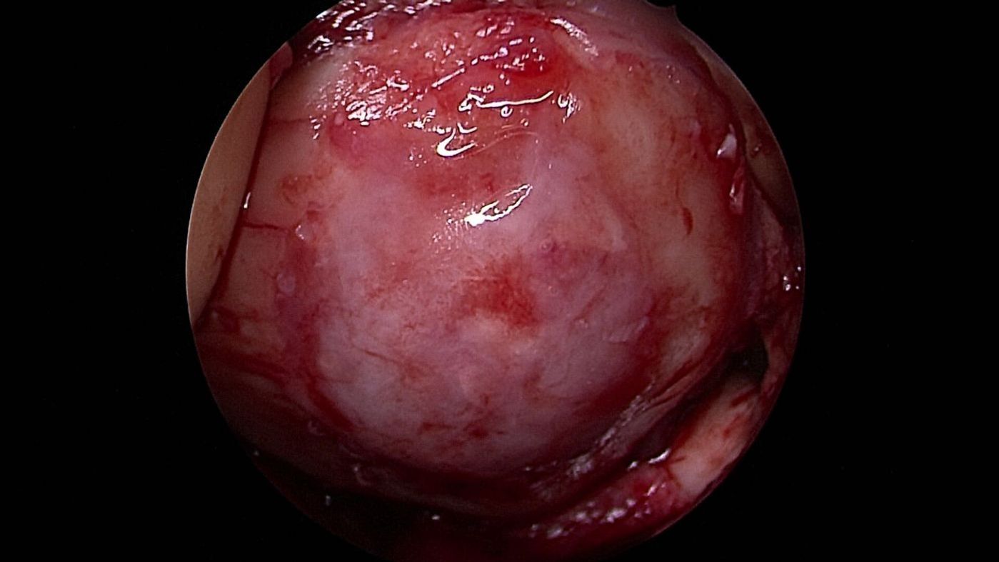 knorpeltransplantation-orthopaedie-unfallchirurgie-waldkrankenhaus-erlangen