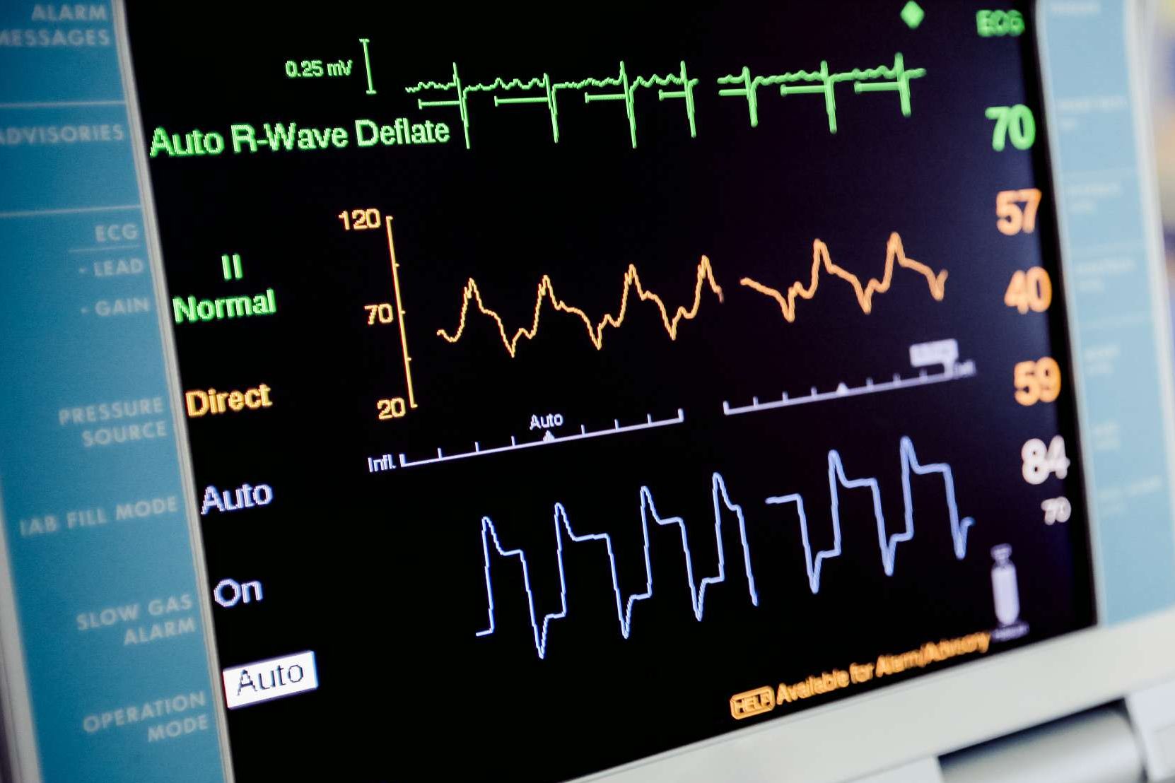EKG Monitor 