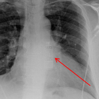 eventrekorder-kardiologie-angiologie-waldkrankenhaus-erlang