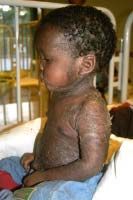 A boy sits in profile on a hospice bed.
