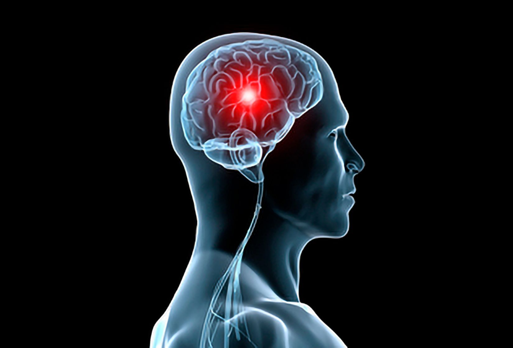 Abbild Stroke Unit