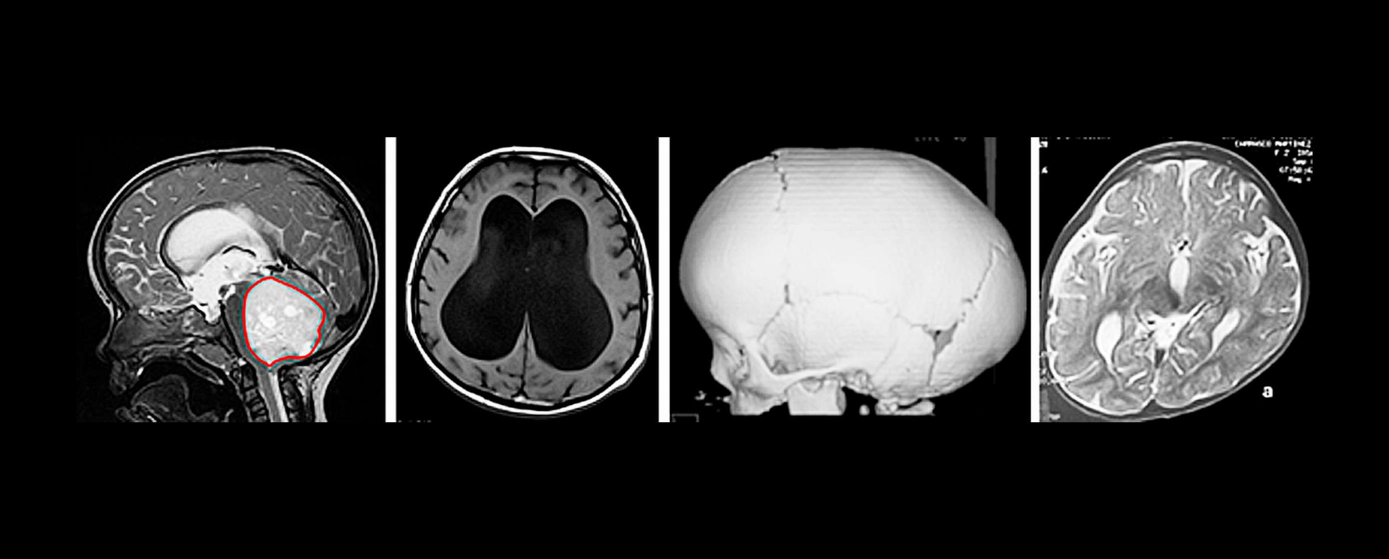 Abbild Kinderneurochirurgie