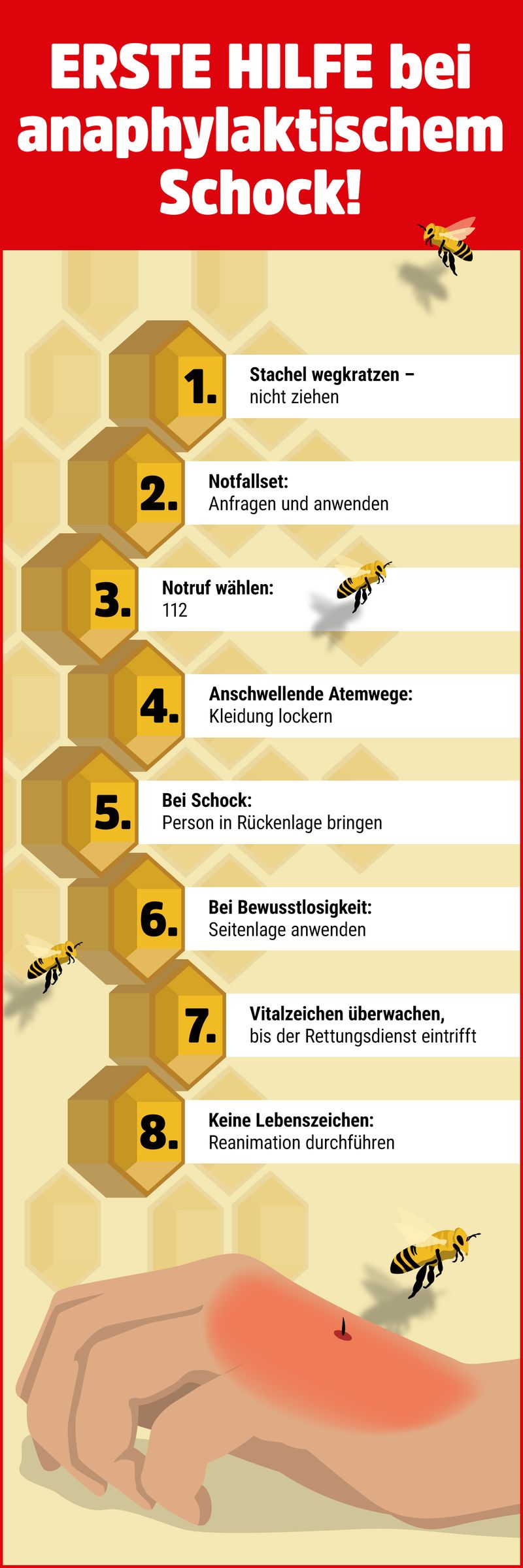 Erste Hilfe nach Wespen oder Bienenstich Das kannst du tun.