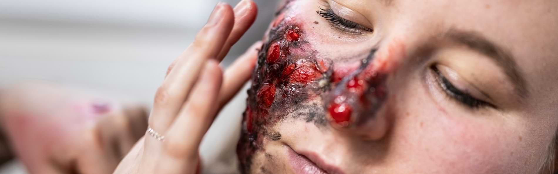 Die Hände einer Frau, die eine künstliche Brandwunde auf das Gesicht einer anderen Frau auftragen. 