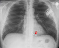 zweikammer-kardiologie-angiologie-waldkrankenhaus-erlangen