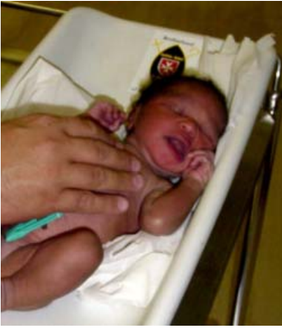 Newborn Sibusiso lying on a care table.